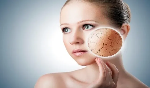 Kış Aylarında Cilt Kuruluğuna Dikkat