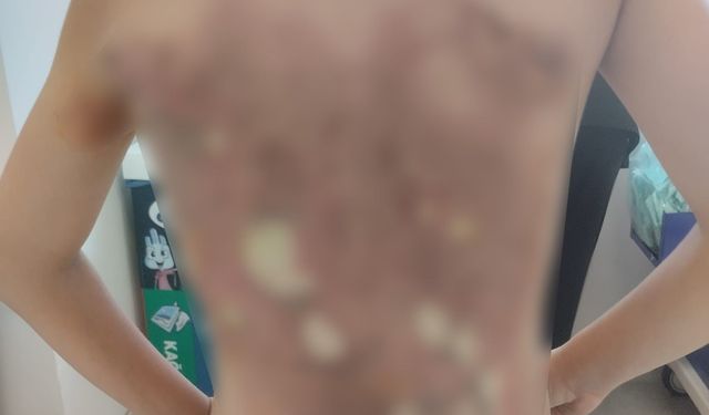 “Kaydıraktan Düştü” Dediler, Gerçek Hastanede Ortaya Çıktı