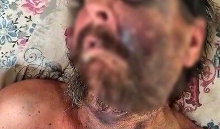 Önce darp edildi, sonra metruk evde ölüme terk edildi