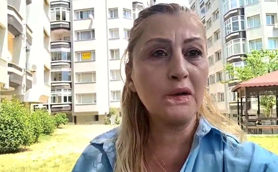 Estetik işlem sonrası dudağı çürüdü, 7 yıldır hukuk mücadelesi veriyor