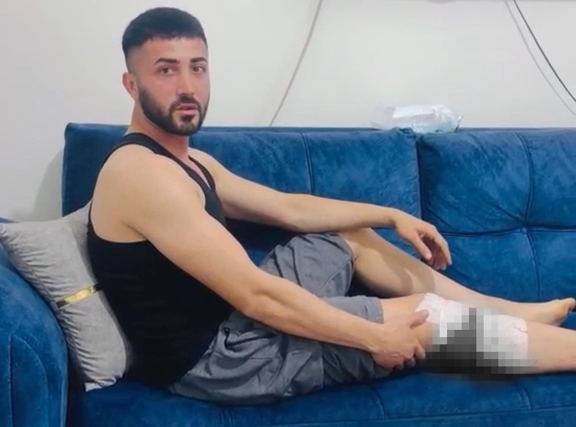 Nizip'te başıboş köpek saldırısında yaralanan 2 kişi belediyeye tepki gösterdi